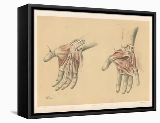 The Upper Limb. Superficial and Deep Views of the Palm of the Hand-G. H. Ford-Framed Stretched Canvas