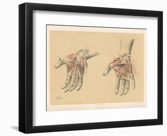 The Upper Limb. Superficial and Deep Views of the Palm of the Hand-G. H. Ford-Framed Giclee Print