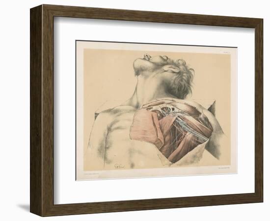 The Upper Limb. The Axillary Vessels, and the Brachial Plexus of Nerves, with their Branches-G. H. Ford-Framed Giclee Print