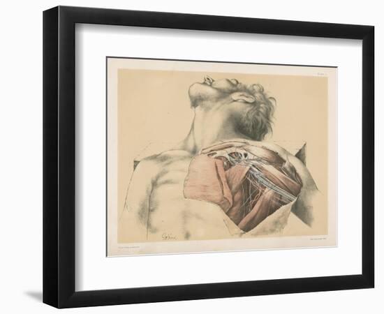 The Upper Limb. The Axillary Vessels, and the Brachial Plexus of Nerves, with their Branches-G. H. Ford-Framed Giclee Print