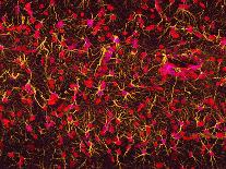 Alzheimer's Disease Brain Cell, TEM-Thomas Deerinck-Photographic Print