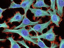 Purkinje Nerve Cells In the Cerebellum-Thomas Deerinck-Photographic Print