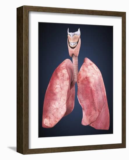 Three Dimensional View of Human Lungs-Stocktrek Images-Framed Art Print
