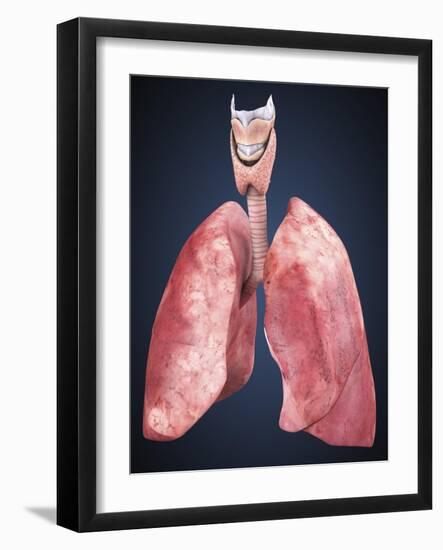 Three Dimensional View of Human Lungs-Stocktrek Images-Framed Art Print