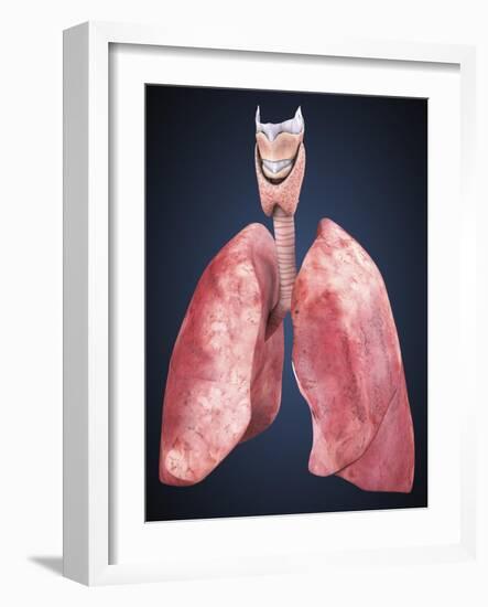 Three Dimensional View of Human Lungs-Stocktrek Images-Framed Art Print