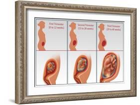 Three Trimesters-Gwen Shockey-Framed Giclee Print