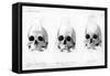 Three Types of Human Skull, 1848-null-Framed Stretched Canvas