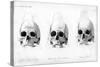 Three Types of Human Skull, 1848-null-Stretched Canvas