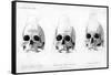 Three Types of Human Skull, 1848-null-Framed Stretched Canvas