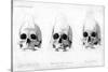 Three Types of Human Skull, 1848-null-Stretched Canvas