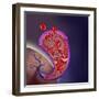 Thrombus Forming on Valve Within Vein-null-Framed Art Print