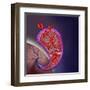 Thrombus Forming on Valve Within Vein-null-Framed Art Print