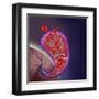 Thrombus Forming on Valve Within Vein-null-Framed Art Print