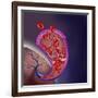 Thrombus Forming on Valve Within Vein-null-Framed Art Print