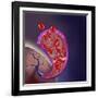 Thrombus Forming on Valve Within Vein-null-Framed Art Print