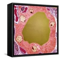 Thyroid Gland Follicle, TEM-Steve Gschmeissner-Framed Stretched Canvas