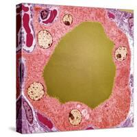 Thyroid Gland Follicle, TEM-Steve Gschmeissner-Stretched Canvas