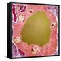 Thyroid Gland Follicle, TEM-Steve Gschmeissner-Framed Stretched Canvas