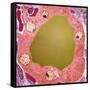 Thyroid Gland Follicle, TEM-Steve Gschmeissner-Framed Stretched Canvas