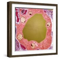 Thyroid Gland Follicle, TEM-Steve Gschmeissner-Framed Premium Photographic Print