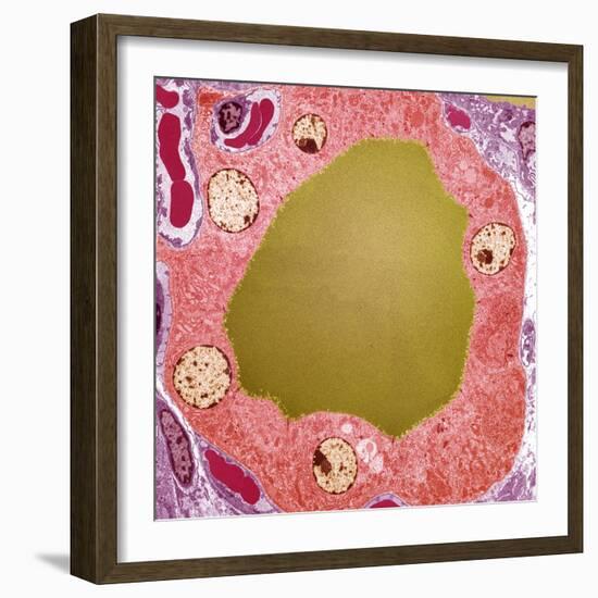 Thyroid Gland Follicle, TEM-Steve Gschmeissner-Framed Premium Photographic Print