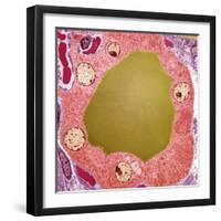 Thyroid Gland Follicle, TEM-Steve Gschmeissner-Framed Premium Photographic Print