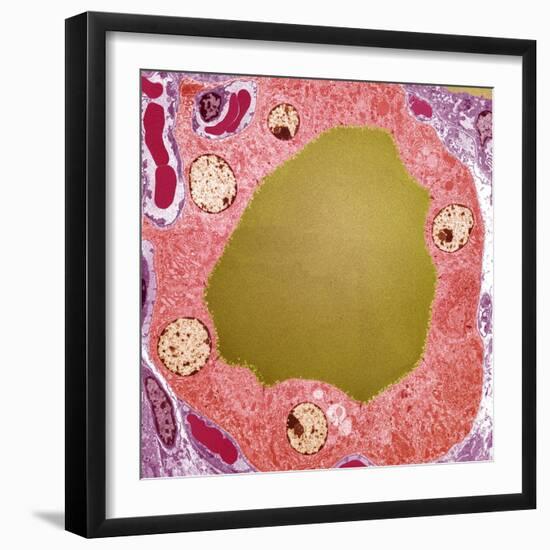Thyroid Gland Follicle, TEM-Steve Gschmeissner-Framed Premium Photographic Print