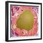 Thyroid Gland Follicle, TEM-Steve Gschmeissner-Framed Premium Photographic Print