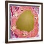 Thyroid Gland Follicle, TEM-Steve Gschmeissner-Framed Photographic Print