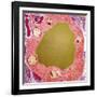 Thyroid Gland Follicle, TEM-Steve Gschmeissner-Framed Photographic Print