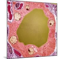 Thyroid Gland Follicle, TEM-Steve Gschmeissner-Mounted Photographic Print