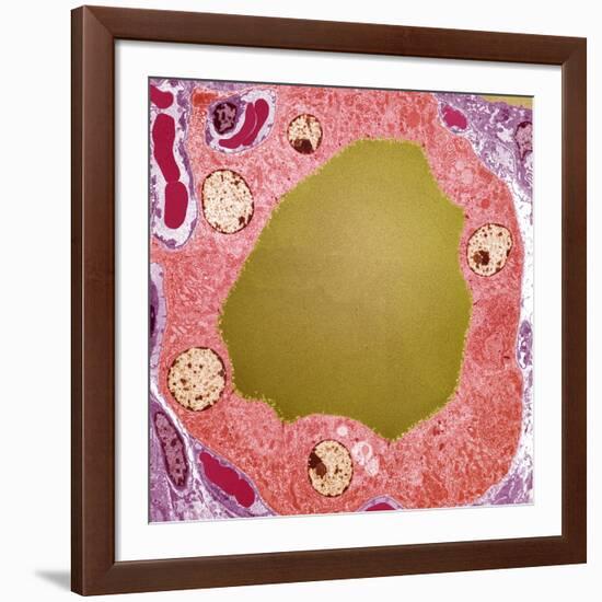 Thyroid Gland Follicle, TEM-Steve Gschmeissner-Framed Photographic Print