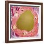 Thyroid Gland Follicle, TEM-Steve Gschmeissner-Framed Photographic Print