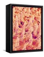 Tongue filiform papillae of a rabbit magnified x300-Micro Discovery-Framed Stretched Canvas