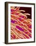 Tongue filiform papillae of a rabbit magnified x300-Micro Discovery-Framed Photographic Print