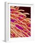 Tongue filiform papillae of a rabbit magnified x300-Micro Discovery-Framed Photographic Print