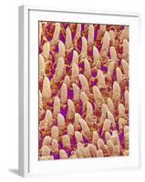 Tongue filiform papillae of a rabbit magnified x300-Micro Discovery-Framed Photographic Print