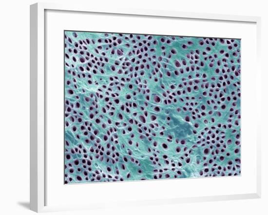 Tooth Dentine, SEM-Steve Gschmeissner-Framed Photographic Print