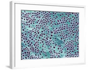 Tooth Dentine, SEM-Steve Gschmeissner-Framed Photographic Print