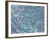 Tooth Dentine, SEM-Steve Gschmeissner-Framed Photographic Print