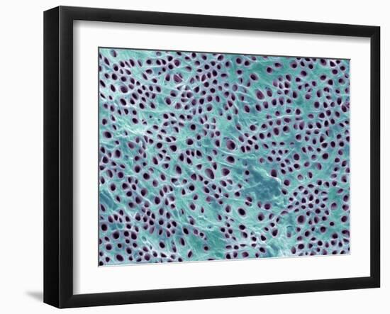 Tooth Dentine, SEM-Steve Gschmeissner-Framed Photographic Print