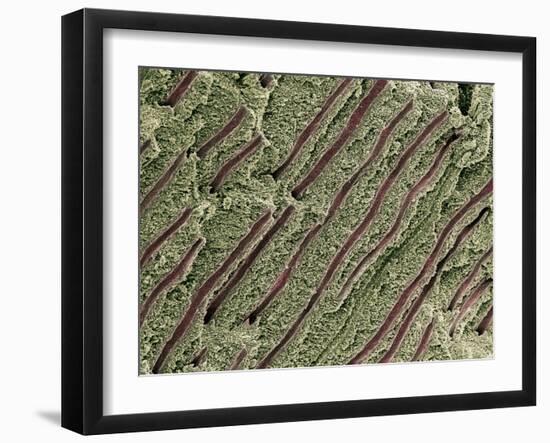 Tooth Dentine, SEM-Steve Gschmeissner-Framed Photographic Print