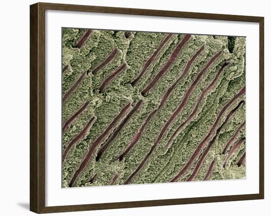 Tooth Dentine, SEM-Steve Gschmeissner-Framed Photographic Print