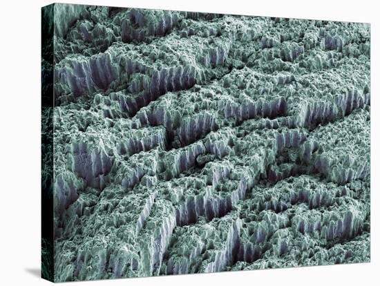 Tooth Enamel, SEM-Steve Gschmeissner-Stretched Canvas