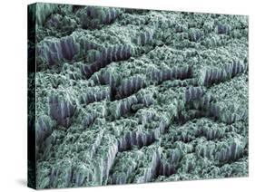 Tooth Enamel, SEM-Steve Gschmeissner-Stretched Canvas