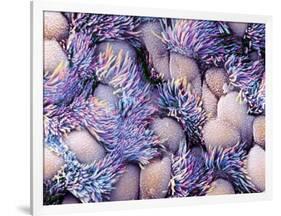 Trachea Lining, SEM-NIBSC-Framed Photographic Print