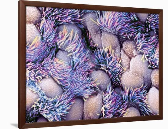 Trachea Lining, SEM-NIBSC-Framed Photographic Print