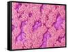 Trachea of a Rat-Micro Discovery-Framed Stretched Canvas