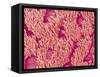 Trachea of a Rat-Micro Discovery-Framed Stretched Canvas