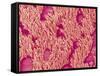 Trachea of a Rat-Micro Discovery-Framed Stretched Canvas